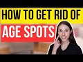 How To Get Rid Of Age Spots | Dermatologist Tips