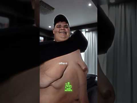 Olha o tanto de peso que o Gordão da XJ perdeu!!! #renatocariani #emagrecimento #juliobalestrin