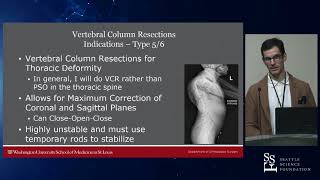 Osteotomies in Spinal Deformity - Michael P. Kelly, MD