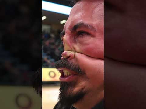 Indigenous Noses