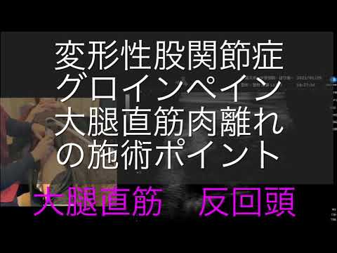 大腿直筋肉離れの施術ポイント／エコー解剖