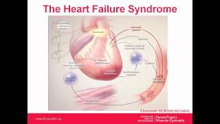 Cardiac Webinar Series: Part 2 - Interventions (November 2012)