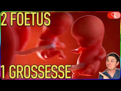 ÉVOLUTION foetus JUMEAUX - Enceint.e jumeaux