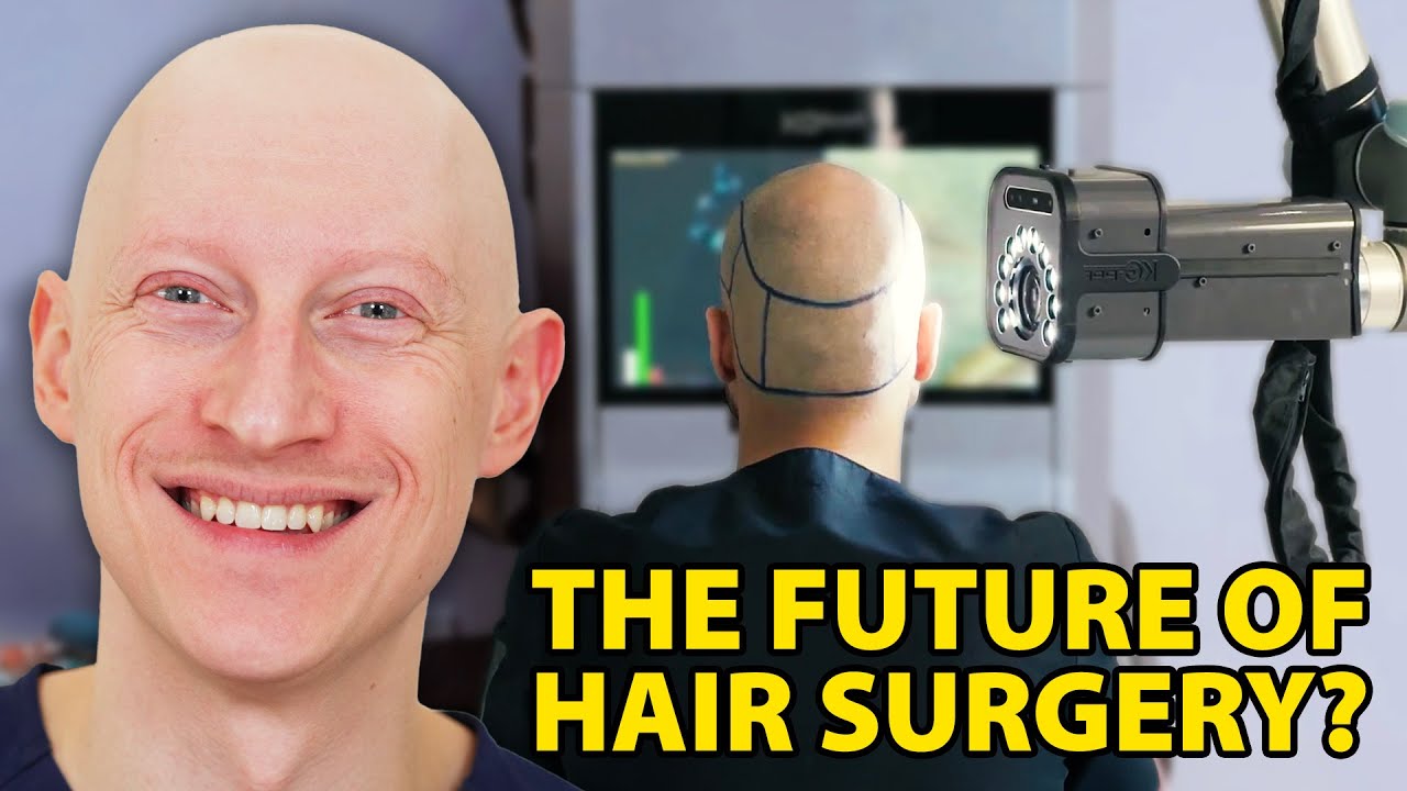 Latest Developments In Hair Transplant Surgery