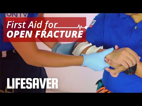 First Aid for Open Fracture | LIFESAVER