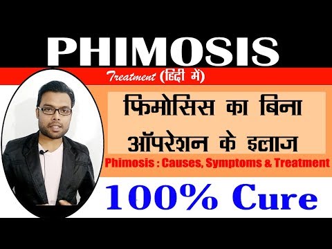 फिमोसिस का बिना ऑपरेशन के इलाज | Treatment of Phimosis in Hindi | Phimosis Medicines | By Dr. Nitish
