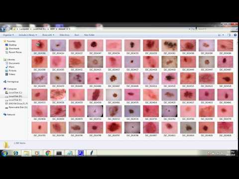 Skin lesion classification using hybrid deep neural networks