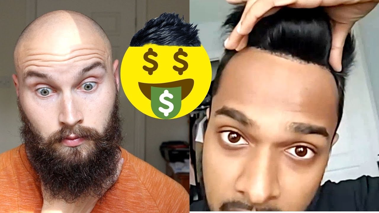 Mens Hair System Cost And Maintenance
