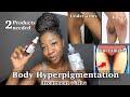HOW TO LIGHTEN DARK INNER THIGHS HYPERPIGMENTATION The Only 2 Products You Need ️