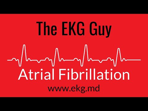 Atrial Fibrillation EKG l The EKG Guy - www.ekg.md