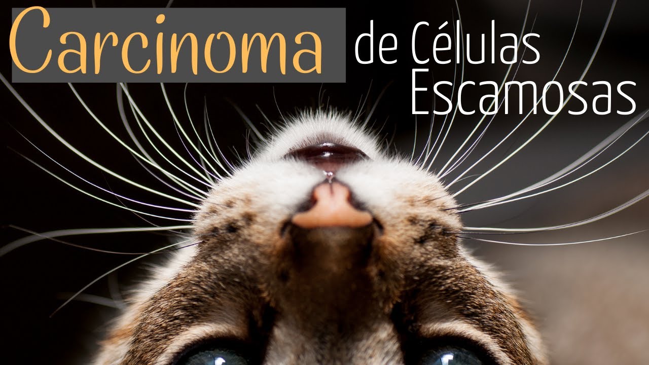 Carcinoma de Células Escamosas