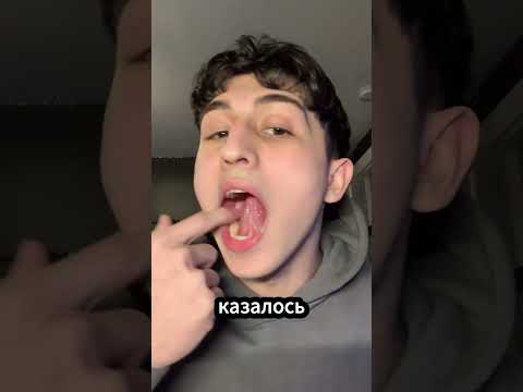 Этот парень обманул всех своим скрытым талантом! ( _@gregsabbak )