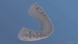 Introducing the NEW CreoKorrekt Thermoformed Aligners (TH)