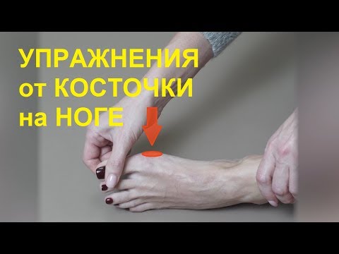 Koślawe stopy na wideo instalacji dzieci Nazwa kości w stopie