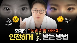눈밑지방 재배치 수술, 왜 부작용 환자가 늘어나는 걸까?