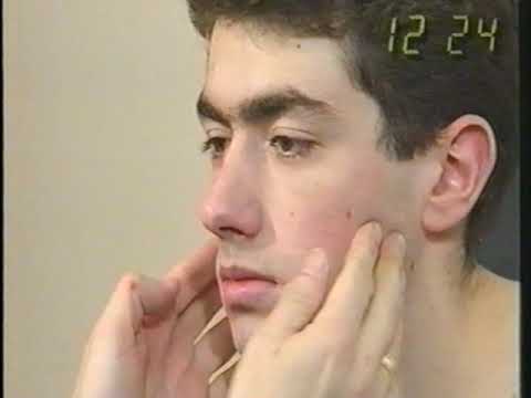 technika badania neurologicznego