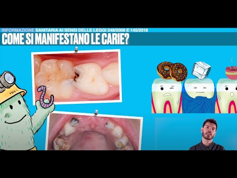 Luca Granatiero-2