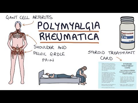 Polymyalgia Rheumatica: Visual Explanation for Students