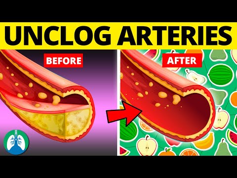 Top 10 Foods to Clean Your Arteries that Can Prevent a Heart Attack