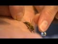 Health Bee Sting Therapy Can Help Common Health Problems