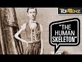 P T Barnum S 10 Most Famous Human Freak Show Attractions