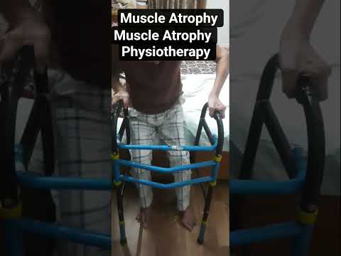 #Muscle Atrophy physiotherapy