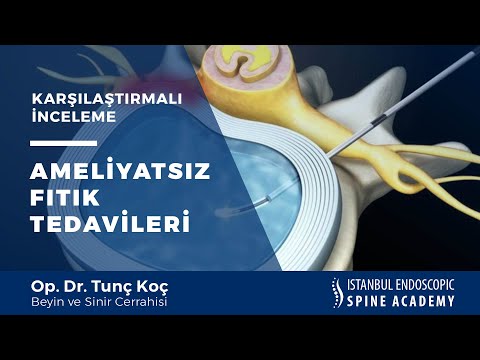 Ameliyatsız Fıtık Tedavileri: Ozon, Lazer ve Radyofrekans