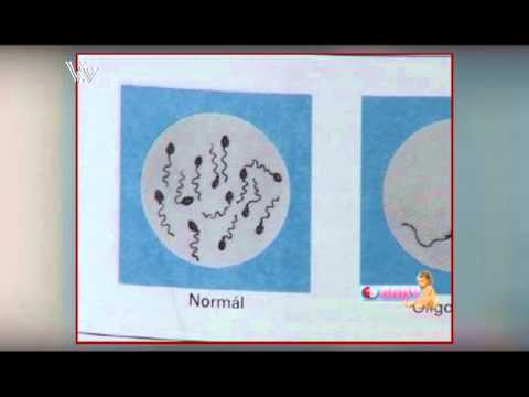 Giardia treatment in humans flagyl