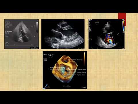 Bits & Pieces in cardiology, Dr Hatim Kheirallah, 1/6/2022