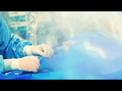 Transcaval Transcatheter Aortic Valve Replacement