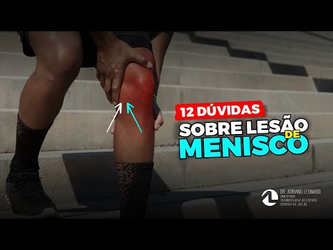 , title : '12 DÚVIDAS MAIS COMUNS SOBRE LESÃO DE MENISCO'