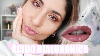AUMENTO DE LABIOS ♡ MI EXPERIENCIA CON DORSIA  | @patrizienta