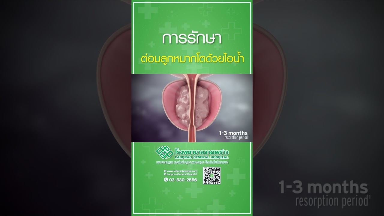 การรักษาต่อมลูกหมากโตด้วยไอน้ำ #ผ่าตัดต่อมลูกหมากโต #ผ่าตัดต่อมลูกหมากโตด้วยไอน้ำ #โรงพยาบาลลาดพร้าว