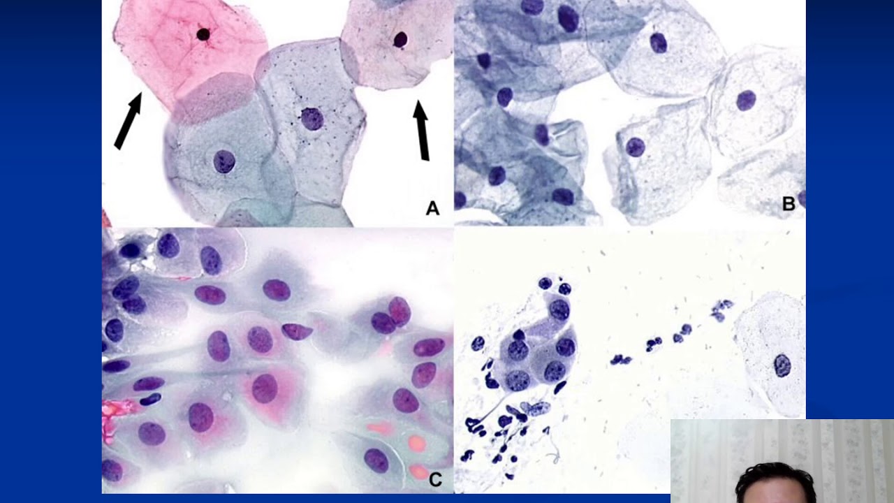 Citologia Ginecológica Geral