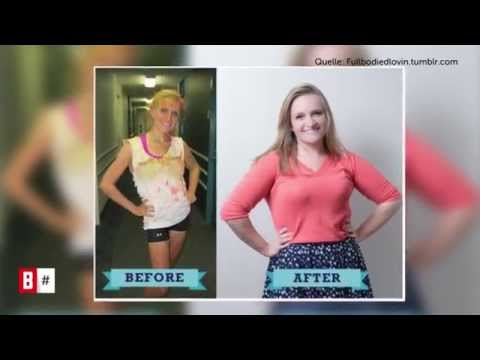 BUNTE TV - Neues Schönheitsideal: Der harte Weg aus der Magersucht!