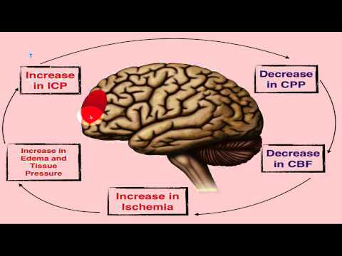 Increased Intracranial Pressure - ICP - EMTprep.com