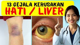 Download lagu 13 Gejala Rusaknya Hati / Liver yang Sering Diremehkan – Waspadai Sebelum Terlambat! mp3