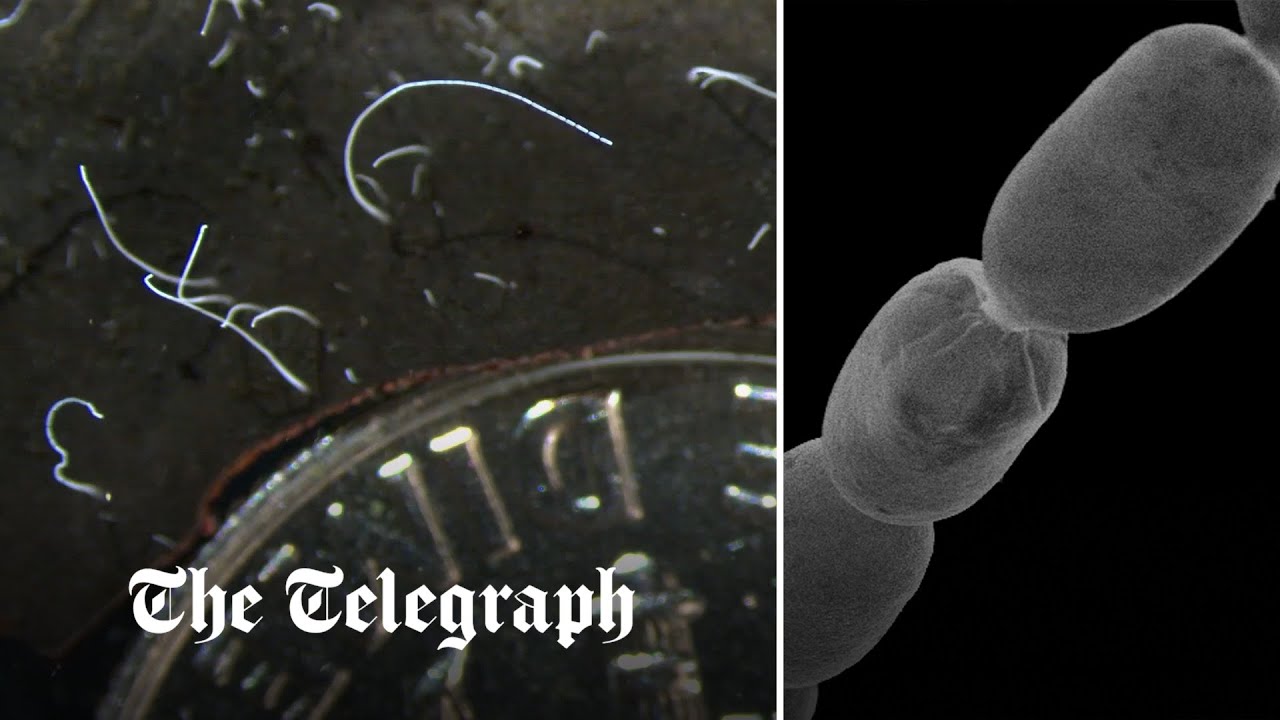 Pictured: Giant bacteria so big they can be picked up with tweezers
