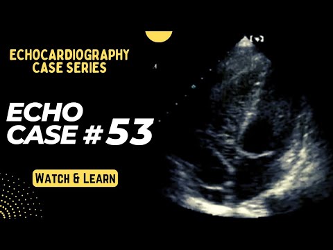 Echocardiography Case 53: Echo Spot Diagnosis Series - Cardiology - Contrast Echocardiogram