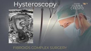 Fibroids surgery (Laparo-Hysteroscopic solution)