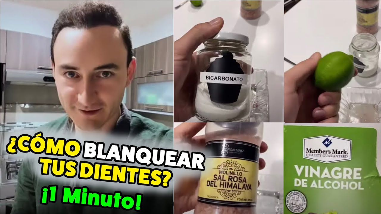 Watch En menos de 1 Minuto: ¿Cómo blanquear tus dientes #shorts Now En menos de 1 Minuto: ¿Cómo blanquear tus dientes #shorts