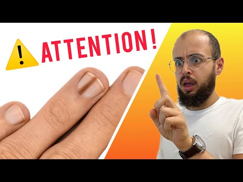 FAITES ATTENTION À VOS ONGLES !