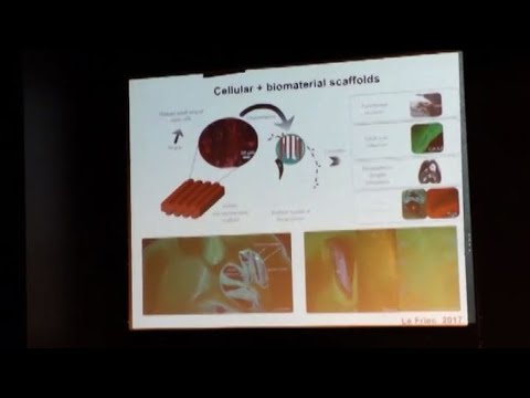 Guarda il video della prostata massaggio donna Prostatite diclofenac vitaprost
