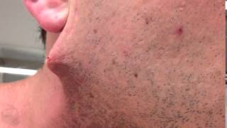 Man shaves his beard off but he got terrified when he found out...