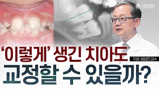 치아 제대로 나 있나요? 치아교정 제대로 하는 법 미리보기