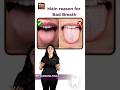 Reasons Behind Bad Breath what to do? | Dr Vandana Daga | FMS Dental