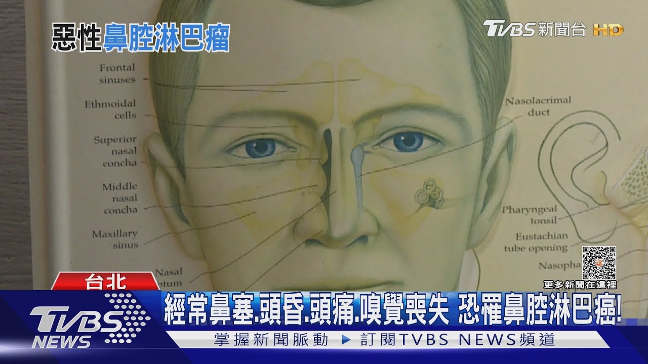 經常出現「這幾種」症狀拖太久 就醫檢查罹「鼻腔淋巴瘤」