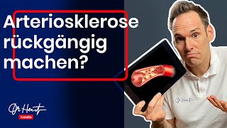 Arteriosklerose rückgängig machen (geht das wirklich) | Dr. Heart