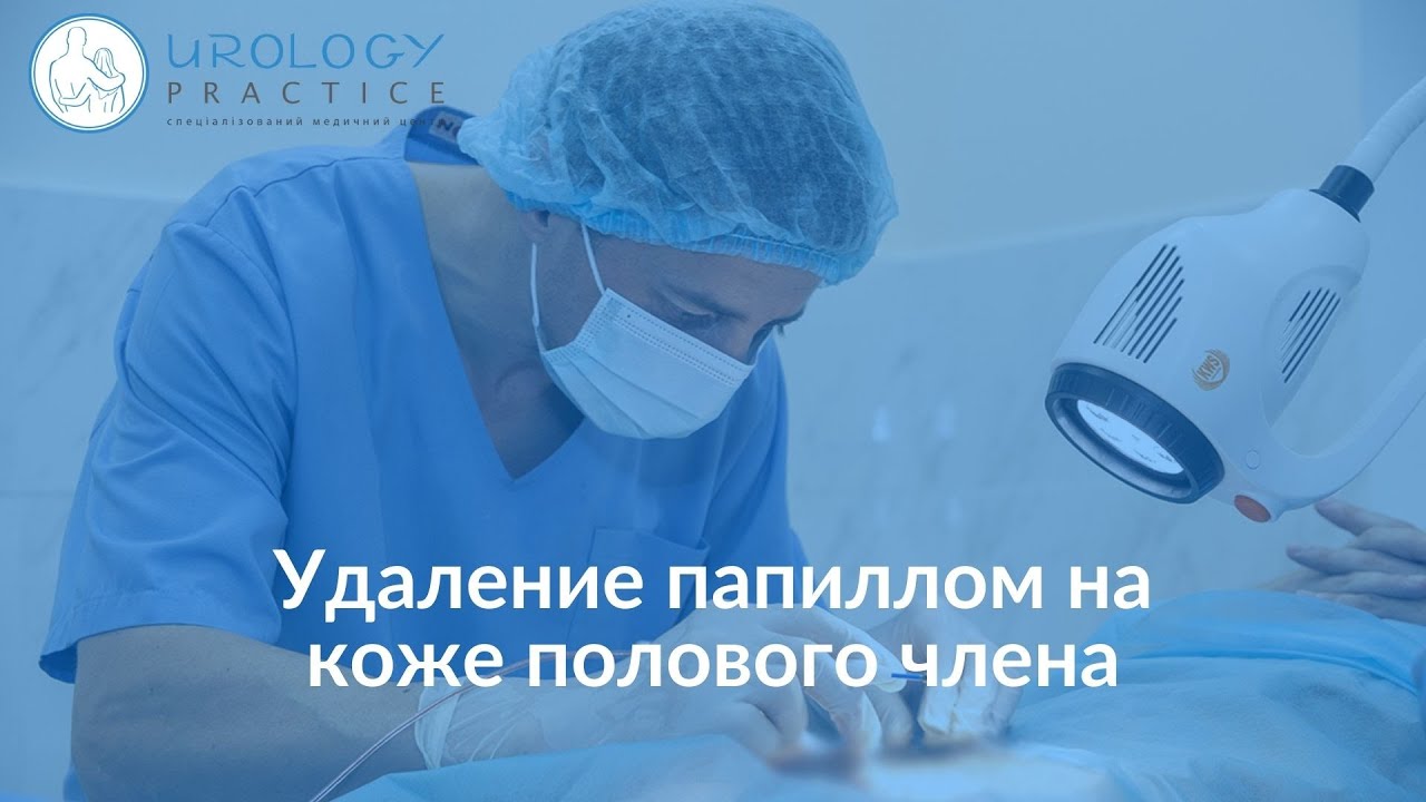 Папиллома Показать Фото