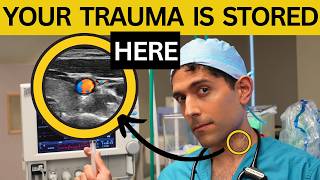 Where is trauma stored in your body? (it’s NOT in your head!)